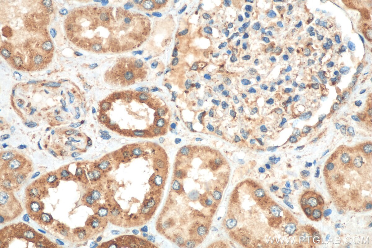 Immunohistochemistry (IHC) staining of human kidney tissue using PPT1 Polyclonal antibody (29653-1-AP)