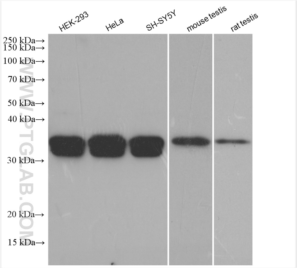 Western Blot (WB) analysis of various lysates using PPT1 Polyclonal antibody (29653-1-AP)
