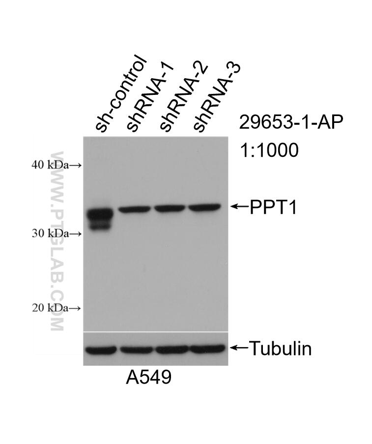 Western Blot (WB) analysis of A549 cells using PPT1 Polyclonal antibody (29653-1-AP)