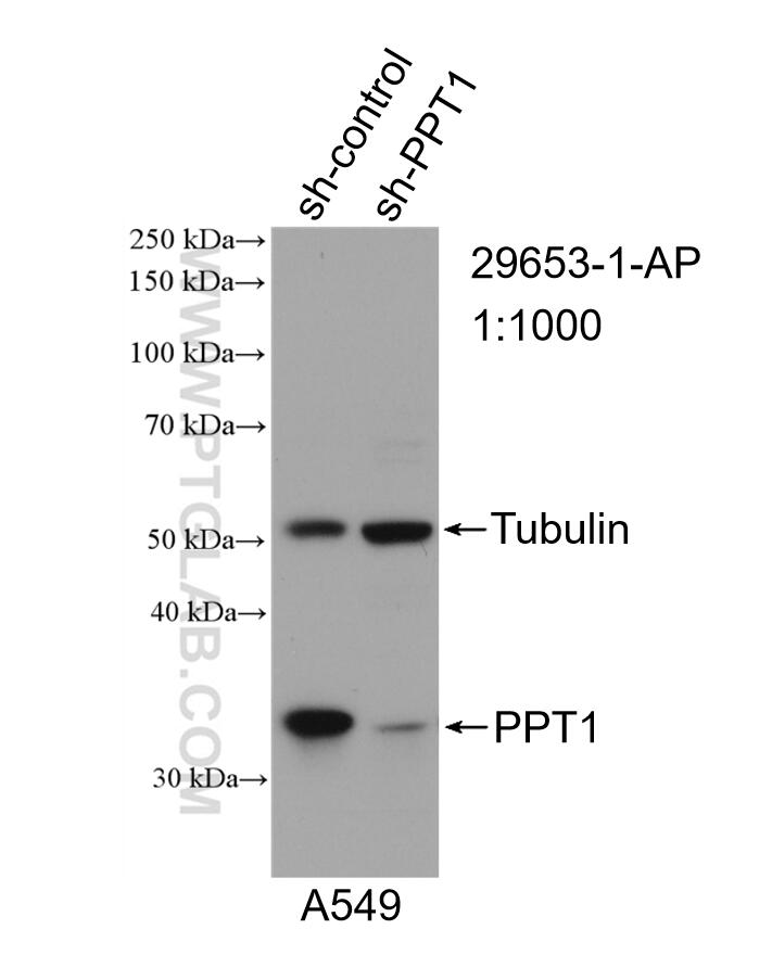 Western Blot (WB) analysis of A549 cells using PPT1 Polyclonal antibody (29653-1-AP)