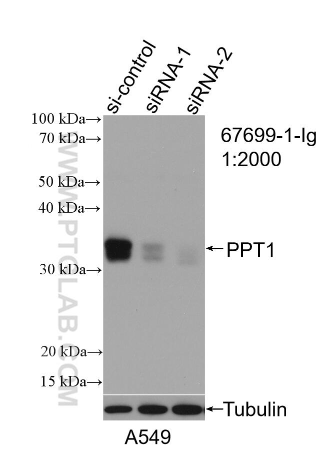 Western Blot (WB) analysis of A549 cells using PPT1 Monoclonal antibody (67699-1-Ig)