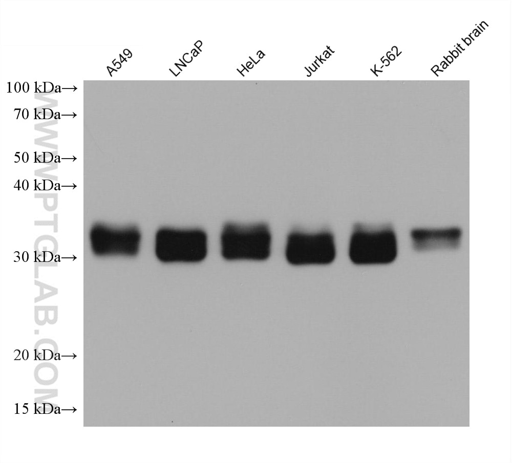 Western Blot (WB) analysis of various lysates using PPT1 Monoclonal antibody (67699-1-Ig)