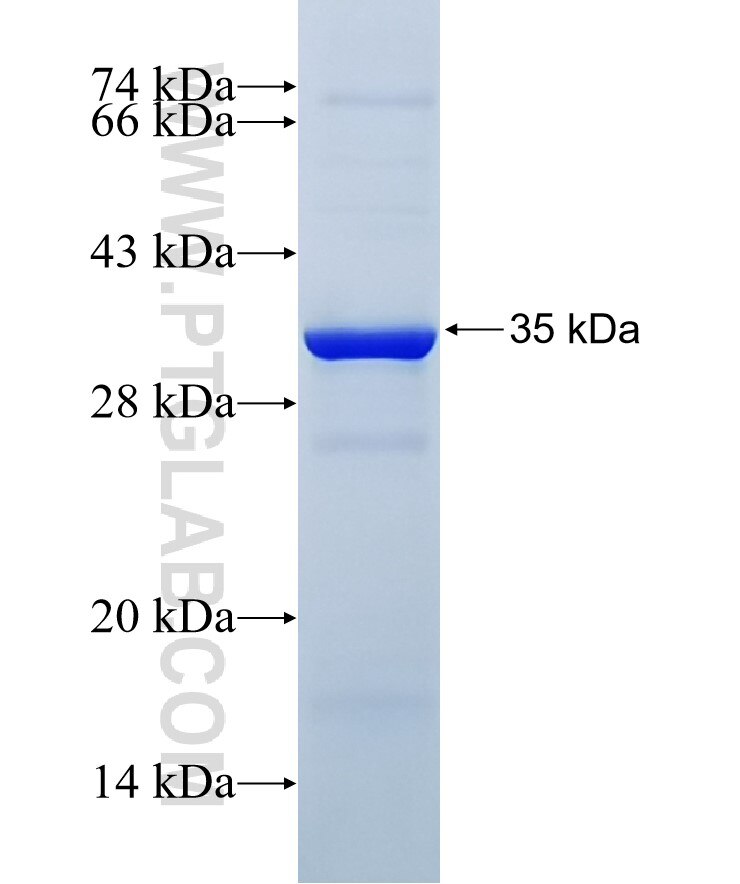 PPT1 fusion protein Ag30550 SDS-PAGE
