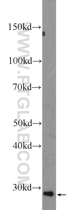 Western Blot (WB) analysis of mouse kidney tissue using PPT2 Polyclonal antibody (15429-1-AP)