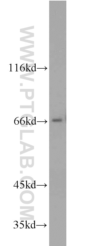 Western Blot (WB) analysis of mouse brain tissue using PPWD1 Polyclonal antibody (17106-1-AP)