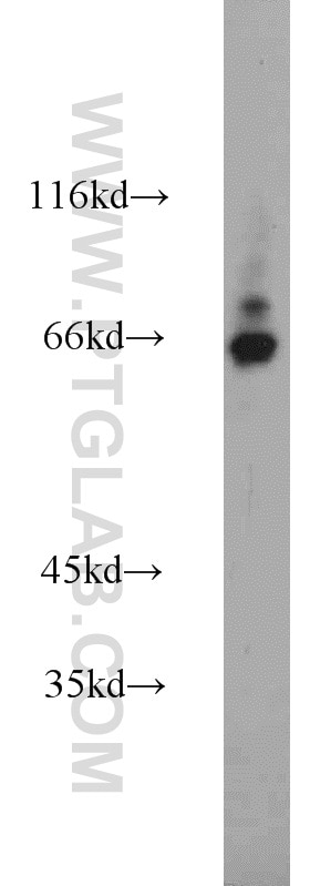 Western Blot (WB) analysis of mouse testis tissue using PPWD1 Polyclonal antibody (17106-1-AP)