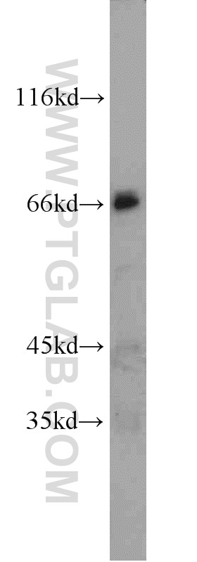 Western Blot (WB) analysis of HeLa cells using PPWD1 Polyclonal antibody (17106-1-AP)
