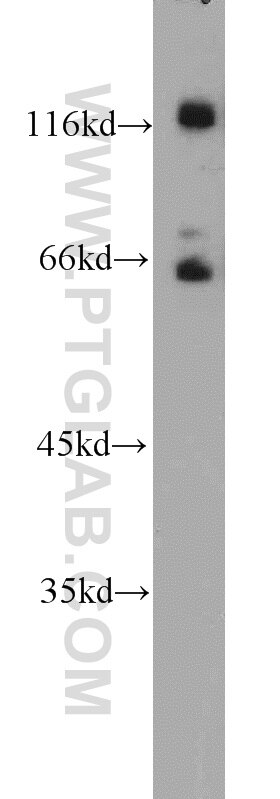 Western Blot (WB) analysis of mouse liver tissue using PPWD1 Polyclonal antibody (17106-1-AP)