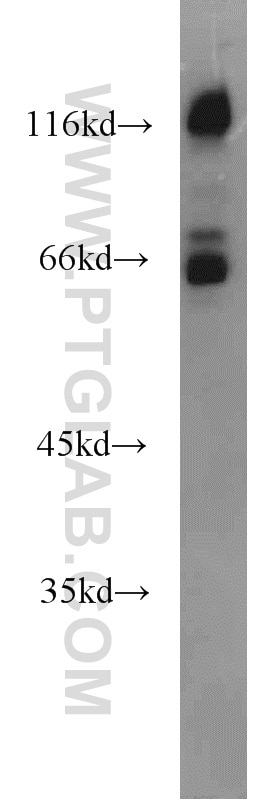 Western Blot (WB) analysis of mouse liver tissue using PPWD1 Polyclonal antibody (17106-1-AP)