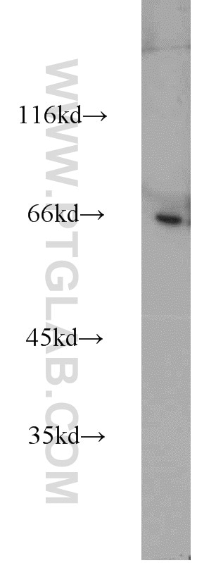 Western Blot (WB) analysis of Sp2/0 cells using PPWD1 Polyclonal antibody (17106-1-AP)