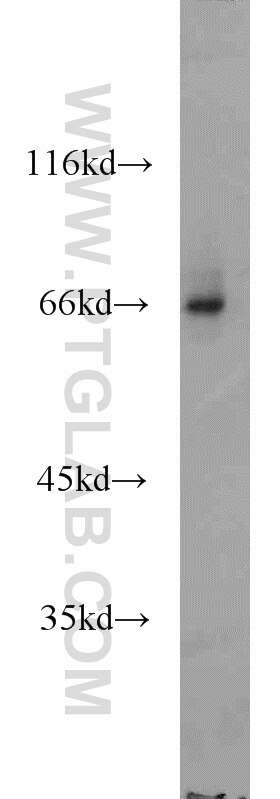 Western Blot (WB) analysis of Sp2/0 cells using PPWD1 Polyclonal antibody (17106-1-AP)