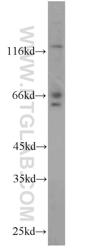 Western Blot (WB) analysis of mouse kidney tissue using PPWD1 Polyclonal antibody (17106-1-AP)