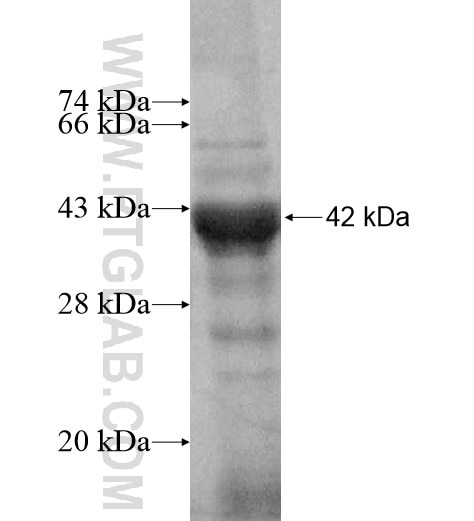 PPWD1 fusion protein Ag10757 SDS-PAGE