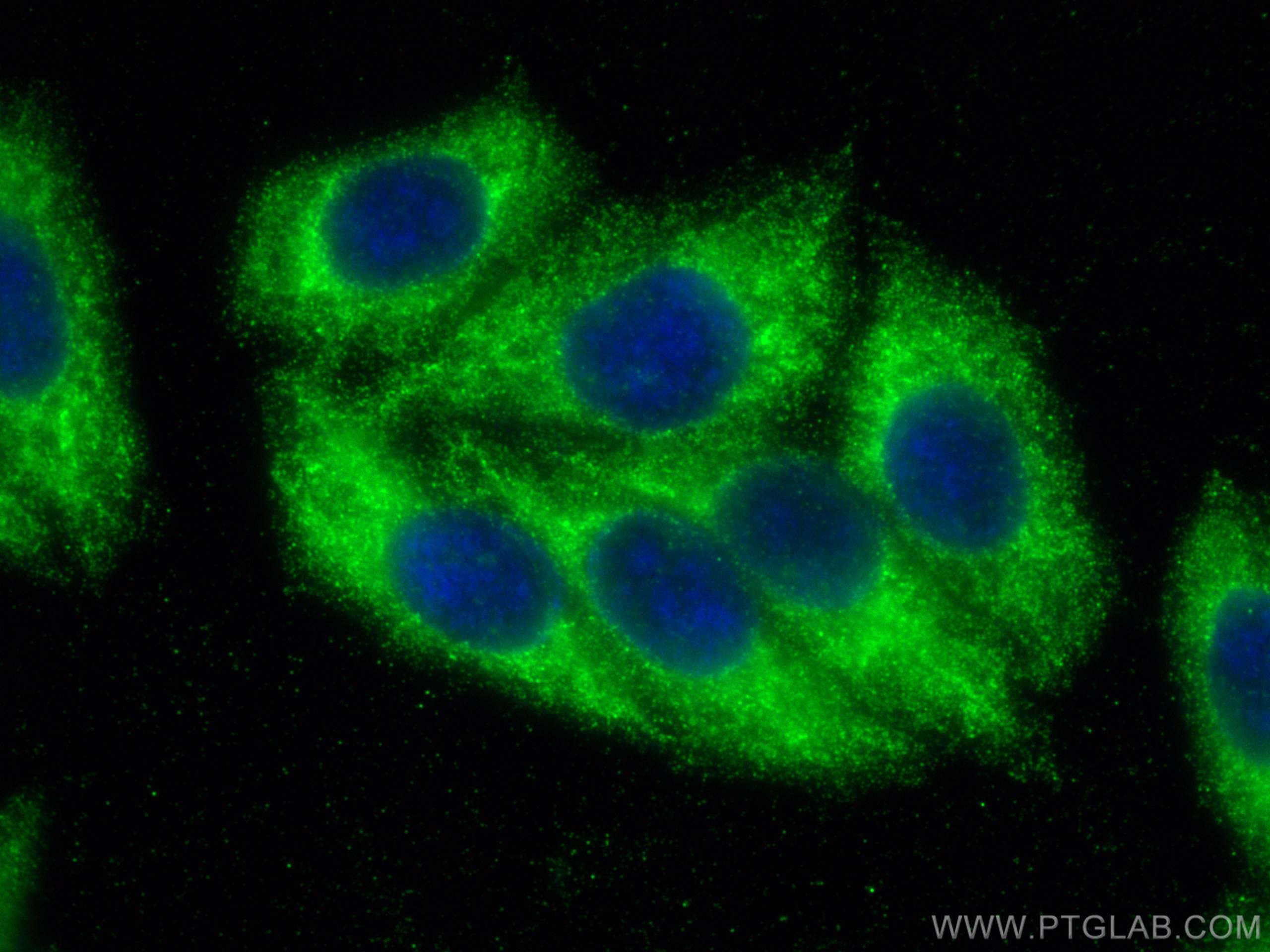 IF Staining of HepG2 using 15493-1-AP