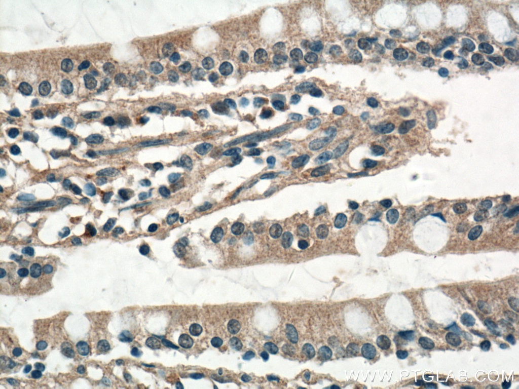 IHC staining of human small intestine using 21654-1-AP