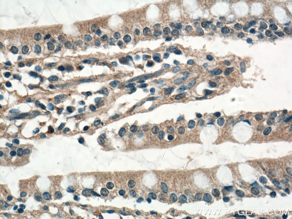 Immunohistochemistry (IHC) staining of human small intestine tissue using PPYR1 Polyclonal antibody (21654-1-AP)