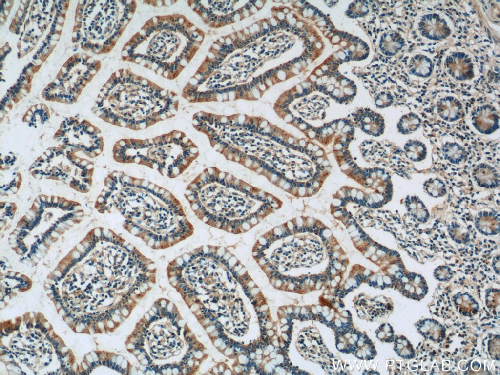 Immunohistochemistry (IHC) staining of human small intestine tissue using PPYR1 Polyclonal antibody (21654-1-AP)