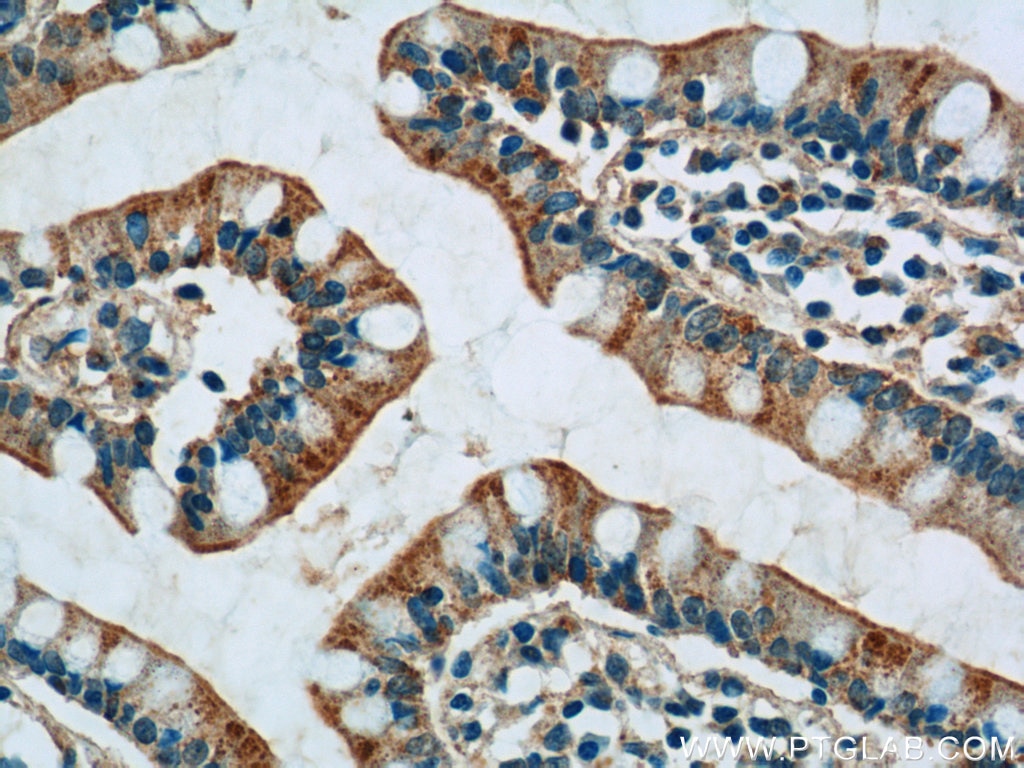Immunohistochemistry (IHC) staining of human small intestine tissue using PPYR1 Polyclonal antibody (21654-1-AP)