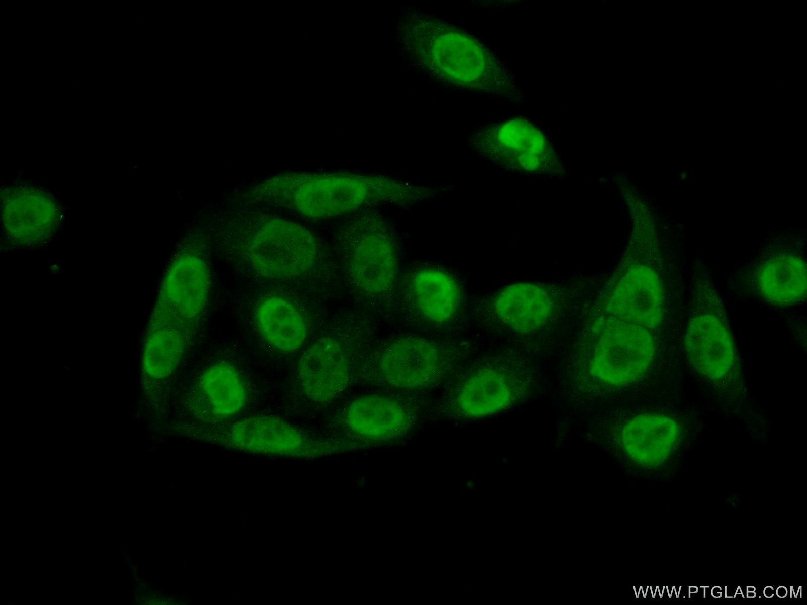 Immunofluorescence (IF) / fluorescent staining of HeLa cells using PQBP1 Polyclonal antibody (16264-1-AP)