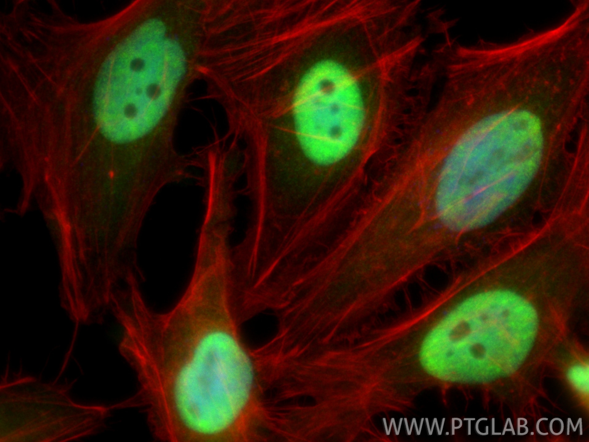 Immunofluorescence (IF) / fluorescent staining of HeLa cells using PQBP1 Polyclonal antibody (16264-1-AP)