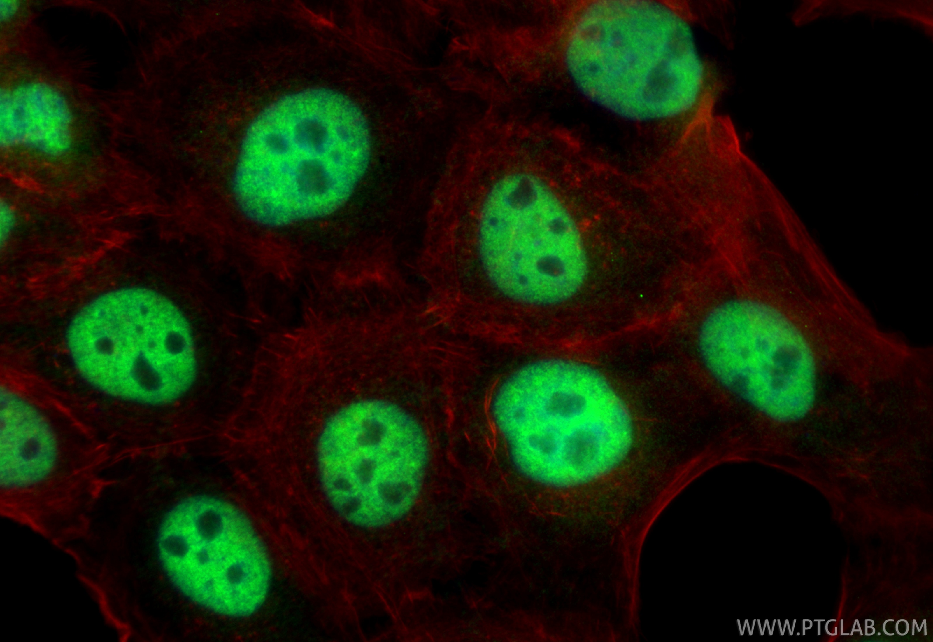 Immunofluorescence (IF) / fluorescent staining of A431 cells using PQBP1 Polyclonal antibody (16264-1-AP)