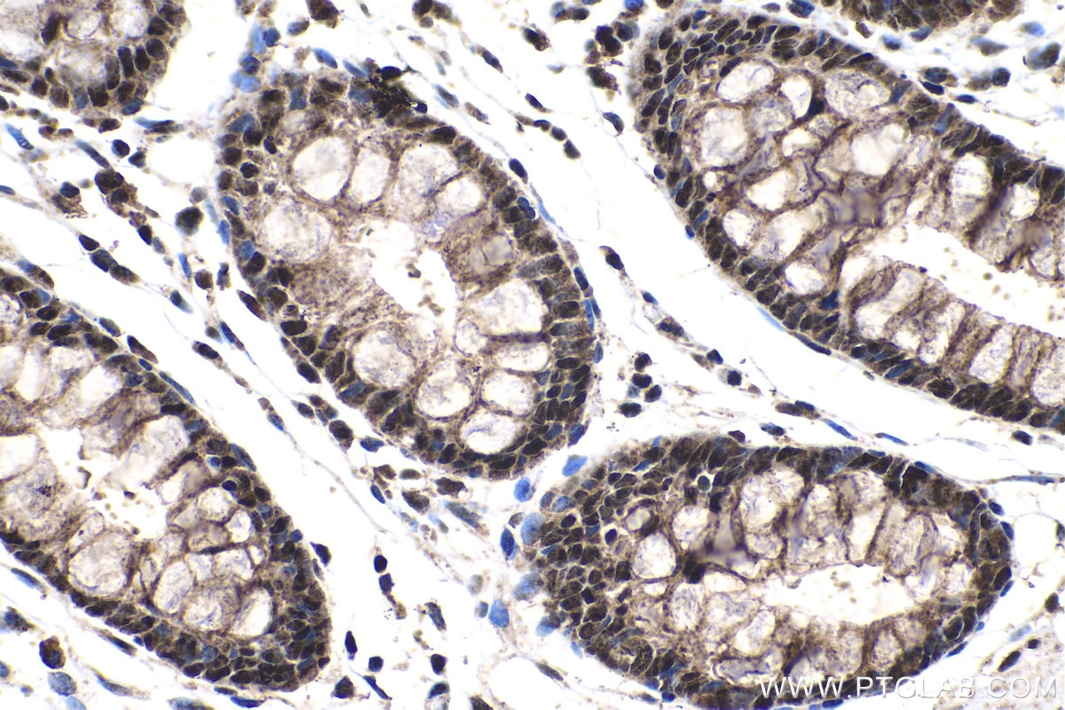 Immunohistochemistry (IHC) staining of human colon tissue using PQBP1 Polyclonal antibody (16264-1-AP)