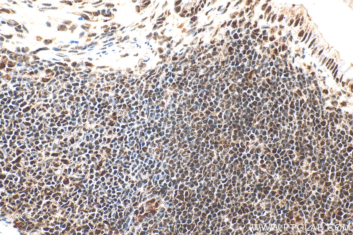 Immunohistochemistry (IHC) staining of mouse colon tissue using PQBP1 Polyclonal antibody (16264-1-AP)