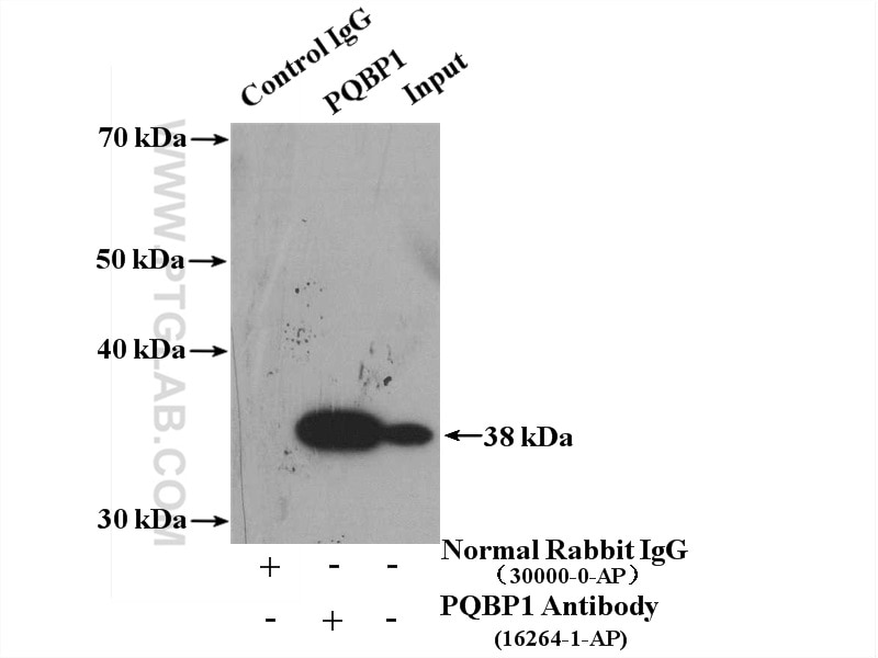 Immunoprecipitation (IP) experiment of mouse brain tissue using PQBP1 Polyclonal antibody (16264-1-AP)