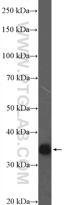 Western Blot (WB) analysis of rat brain tissue using PQBP1 Polyclonal antibody (16264-1-AP)