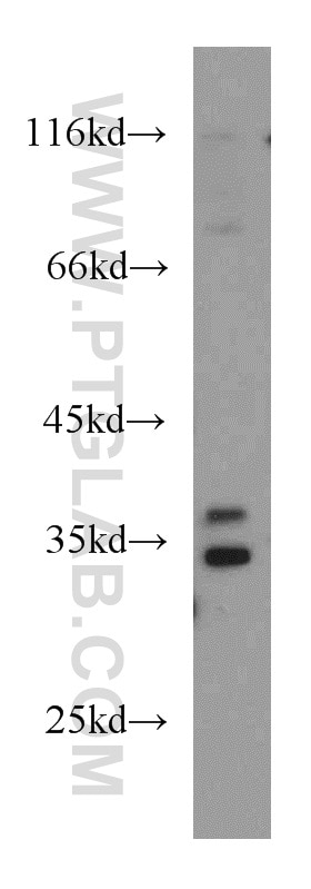 Western Blot (WB) analysis of mouse skeletal muscle tissue using PQBP1 Polyclonal antibody (16264-1-AP)