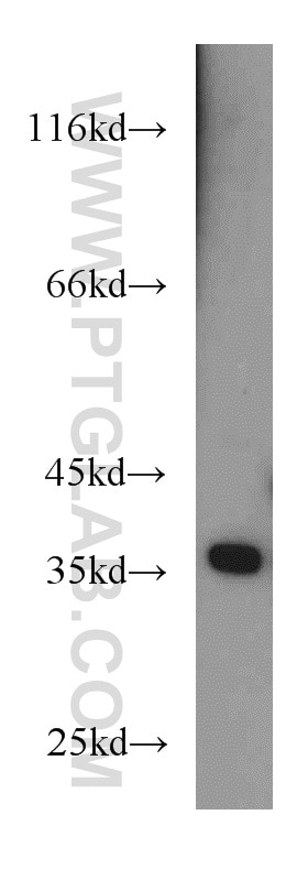 Western Blot (WB) analysis of mouse brain tissue using PQBP1 Polyclonal antibody (16264-1-AP)