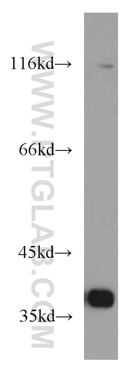 Western Blot (WB) analysis of HeLa cells using PQBP1 Polyclonal antibody (16264-1-AP)