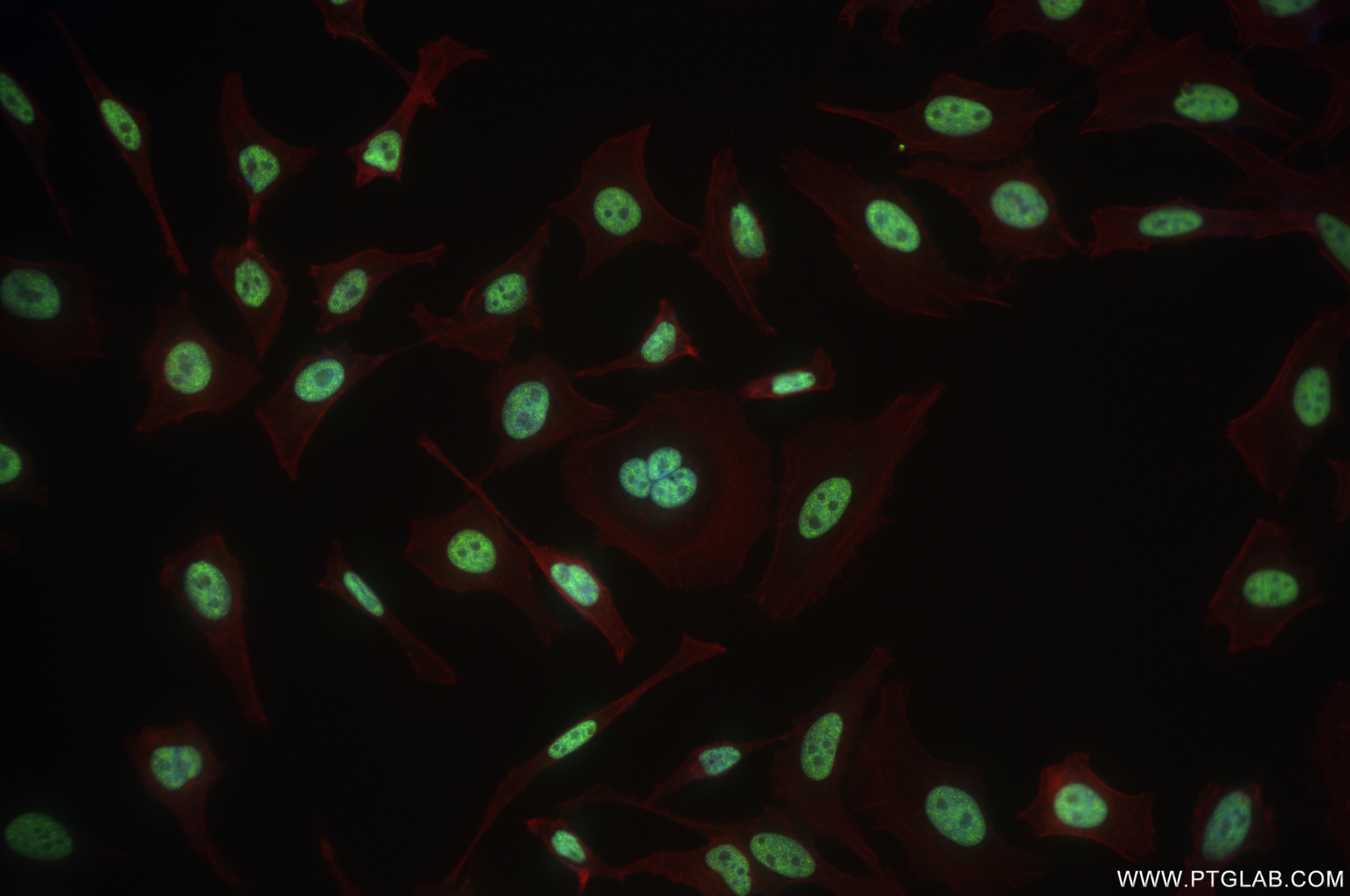 Immunofluorescence (IF) / fluorescent staining of HeLa cells using PQBP1 Recombinant antibody (84491-3-RR)