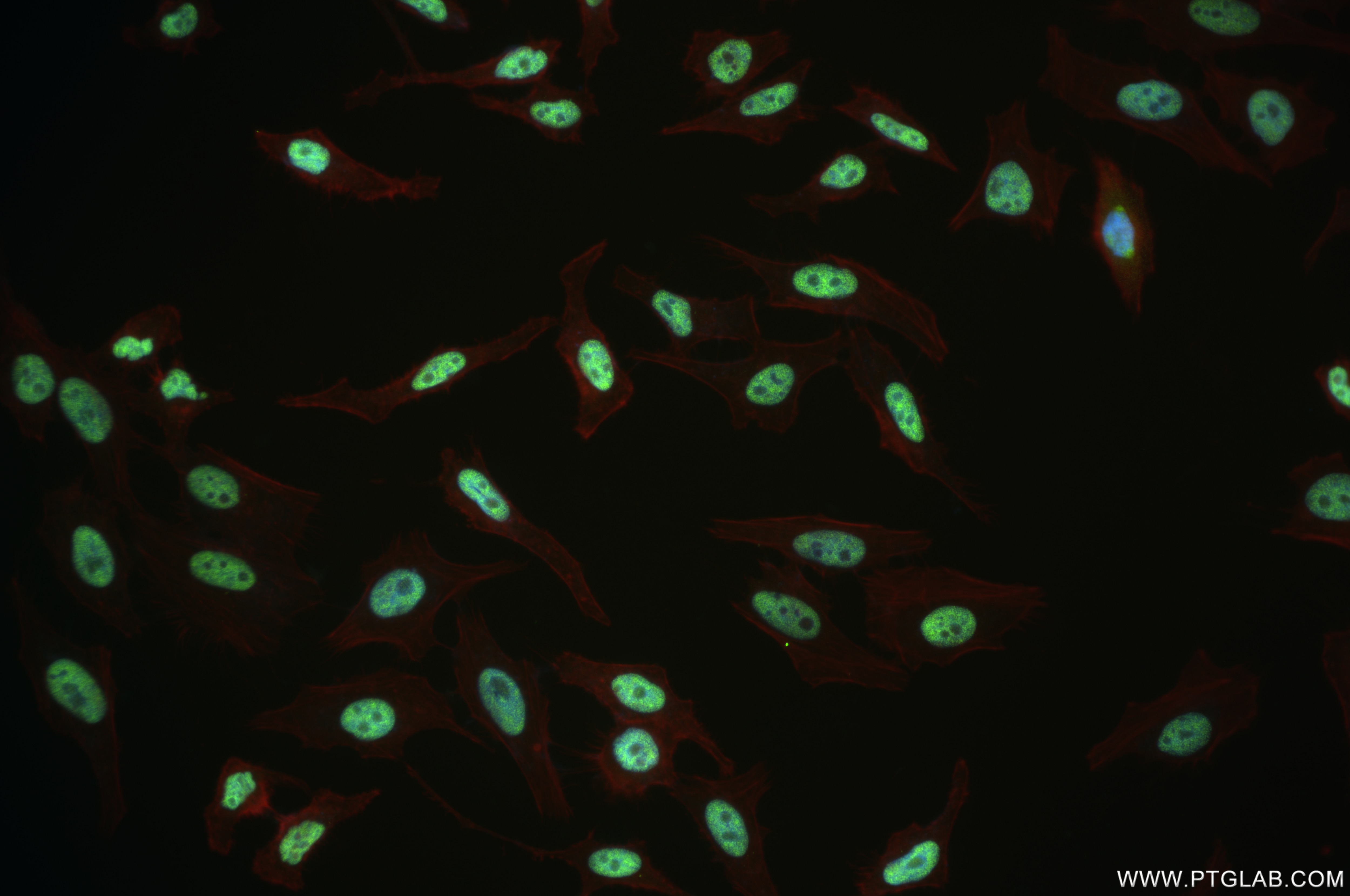 Immunofluorescence (IF) / fluorescent staining of HeLa cells using PQBP1 Recombinant antibody (84491-6-RR)