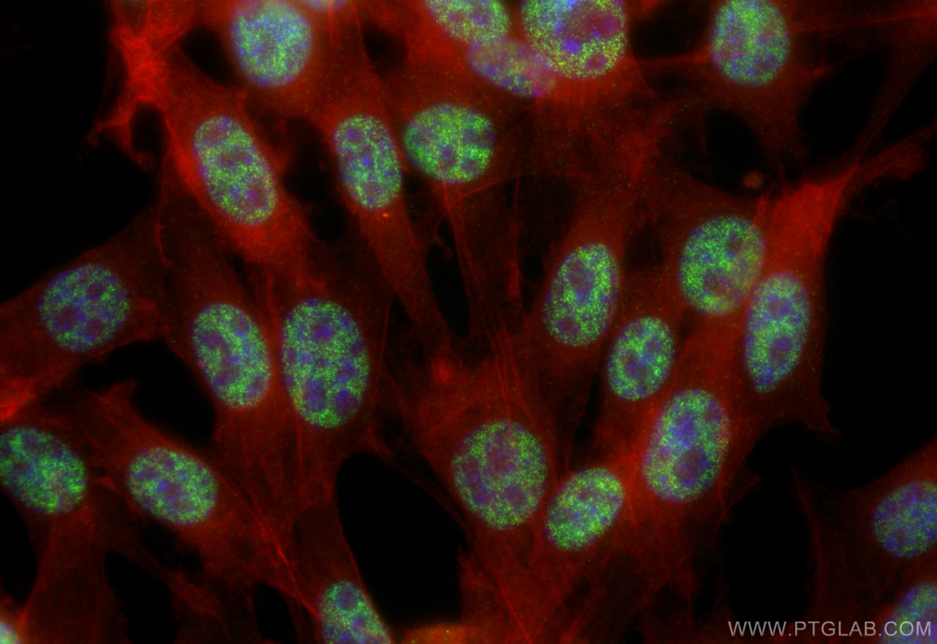 Immunofluorescence (IF) / fluorescent staining of NIH/3T3 cells using PQBP1 Recombinant antibody (84491-6-RR)