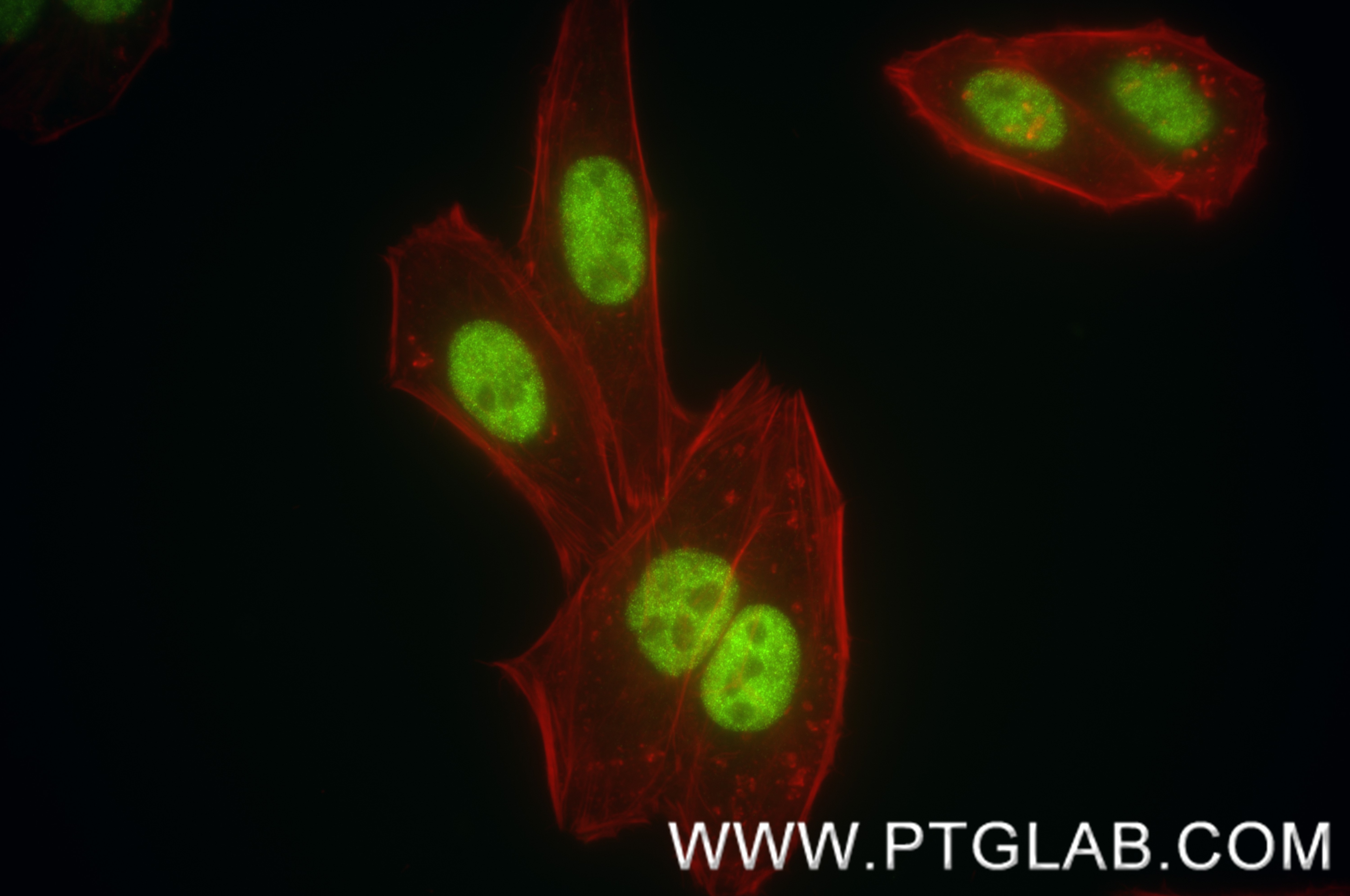 Immunofluorescence (IF) / fluorescent staining of HeLa cells using PQBP1 Recombinant antibody (84491-6-RR)