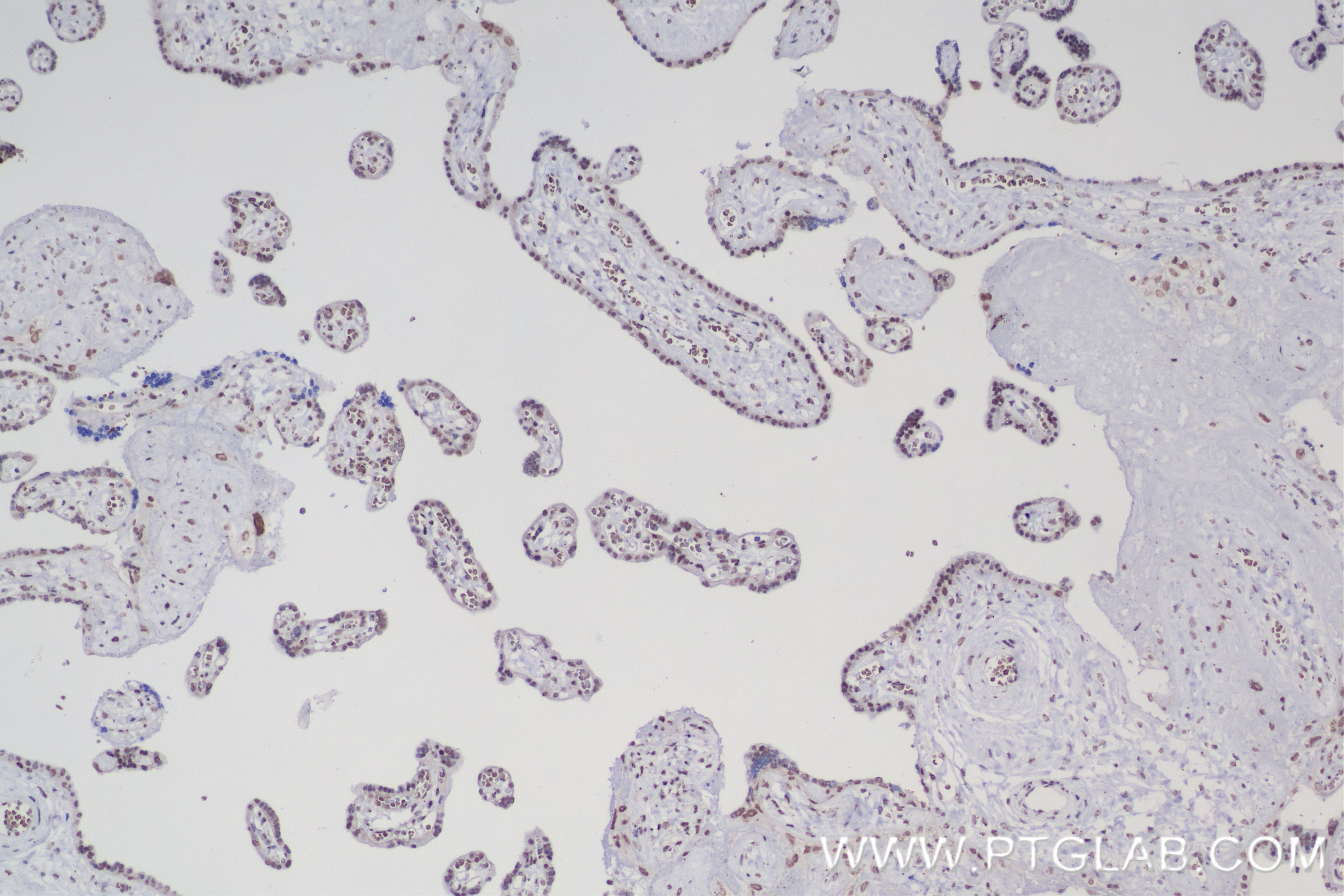 Immunohistochemistry (IHC) staining of human placenta tissue using PQBP1 Recombinant antibody (84491-6-RR)