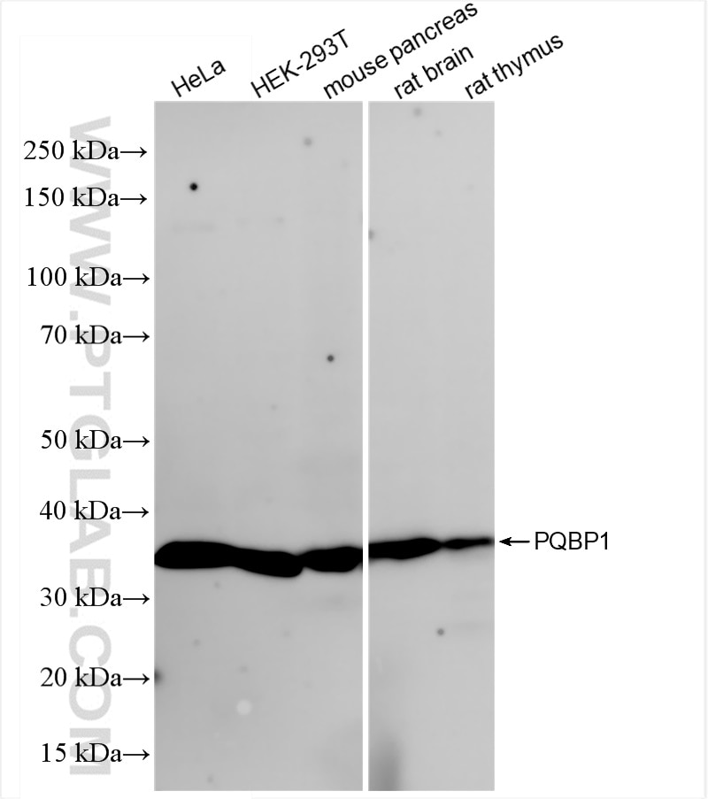 Western Blot (WB) analysis of various lysates using PQBP1 Recombinant antibody (84491-6-RR)