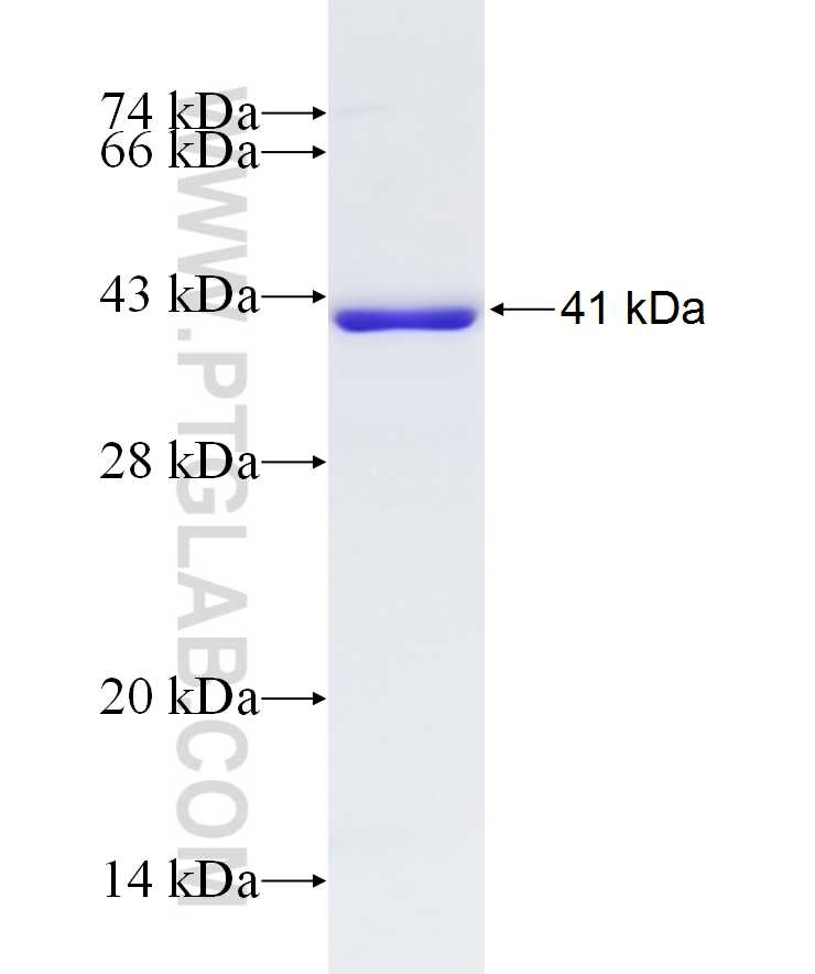 PQBP1 fusion protein Ag9377 SDS-PAGE
