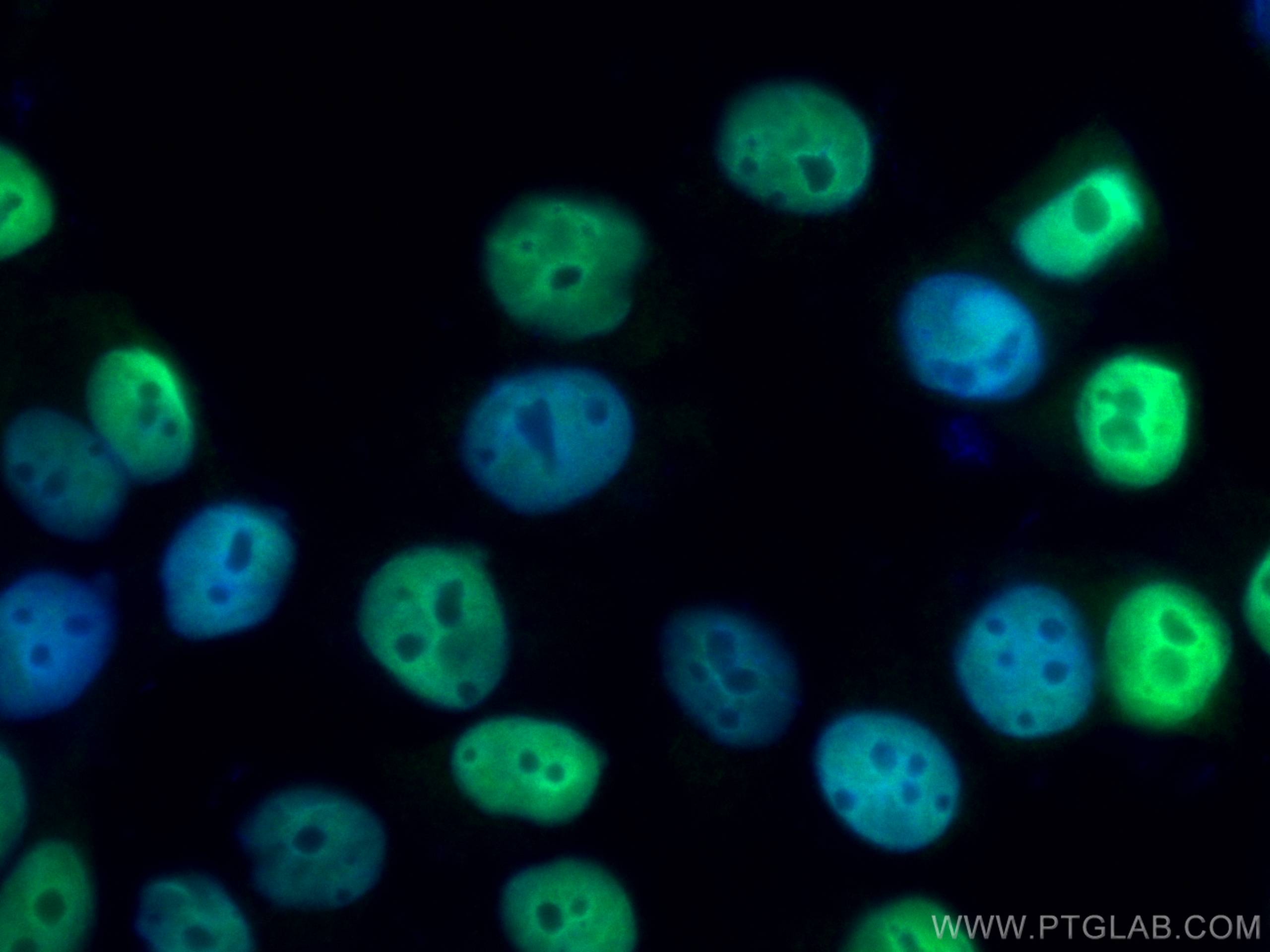 Immunofluorescence (IF) / fluorescent staining of T-47D cells using PR Polyclonal antibody (25871-1-AP)