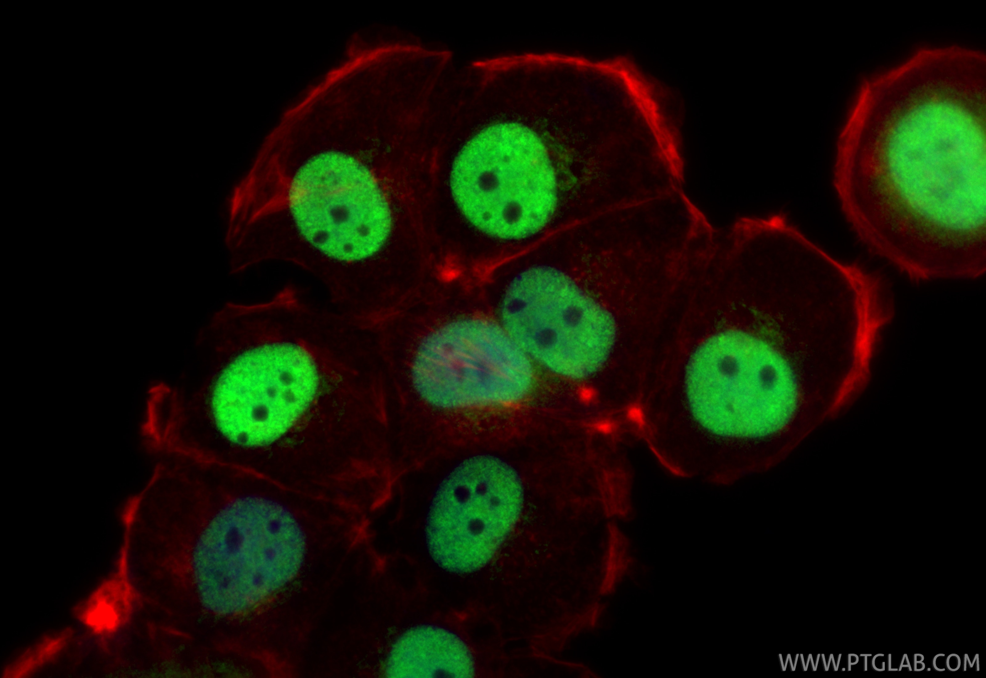 IF Staining of T-47D using 25871-1-AP Immunofluorescence (IF) / fluorescent staining of T-47D cells using Progesterone Receptor Polyclonal antibody (25871-1-AP)