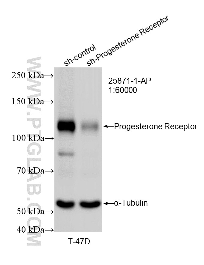 WB analysis of T-47D using 25871-1-AP Western Blot (WB) analysis of T-47D cells using Progesterone Receptor Polyclonal antibody (25871-1-AP)
