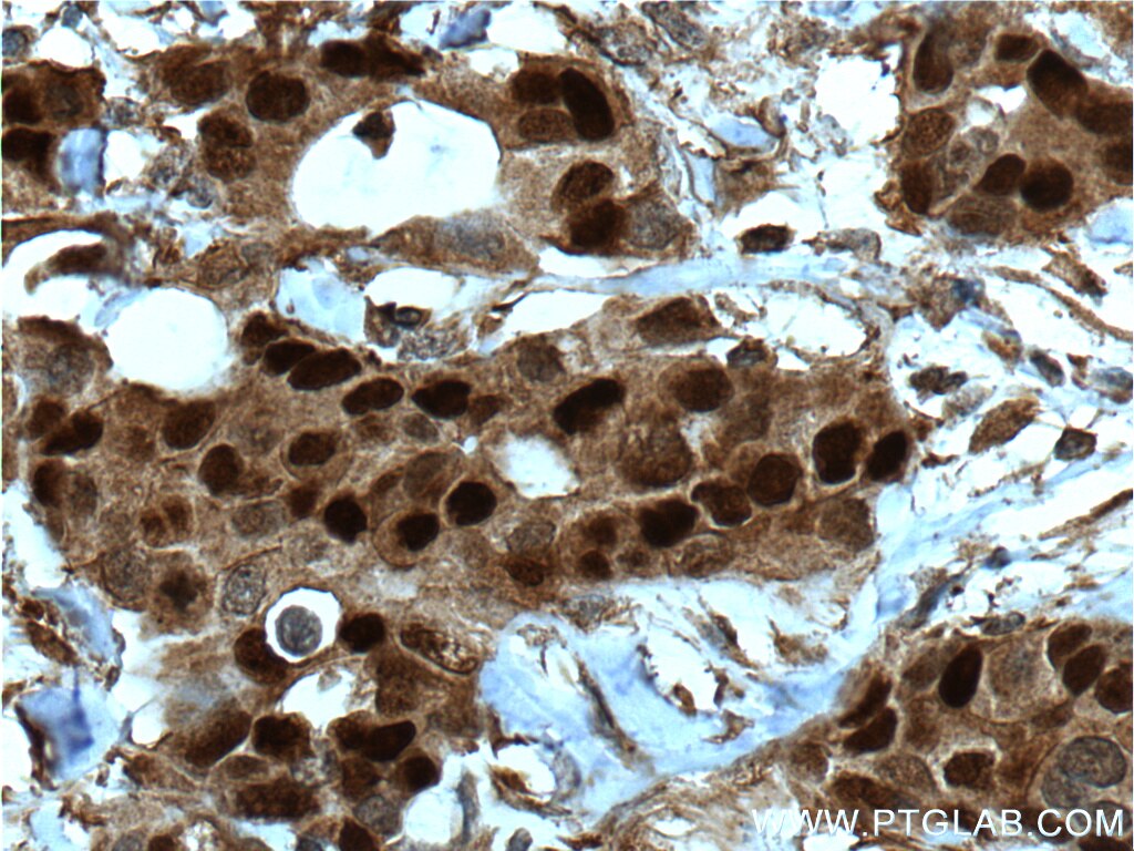 pr antibody pr antibody