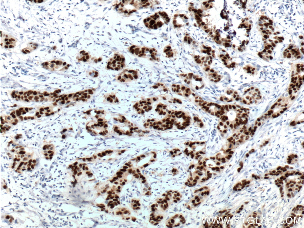 PR Monoclonal antibody