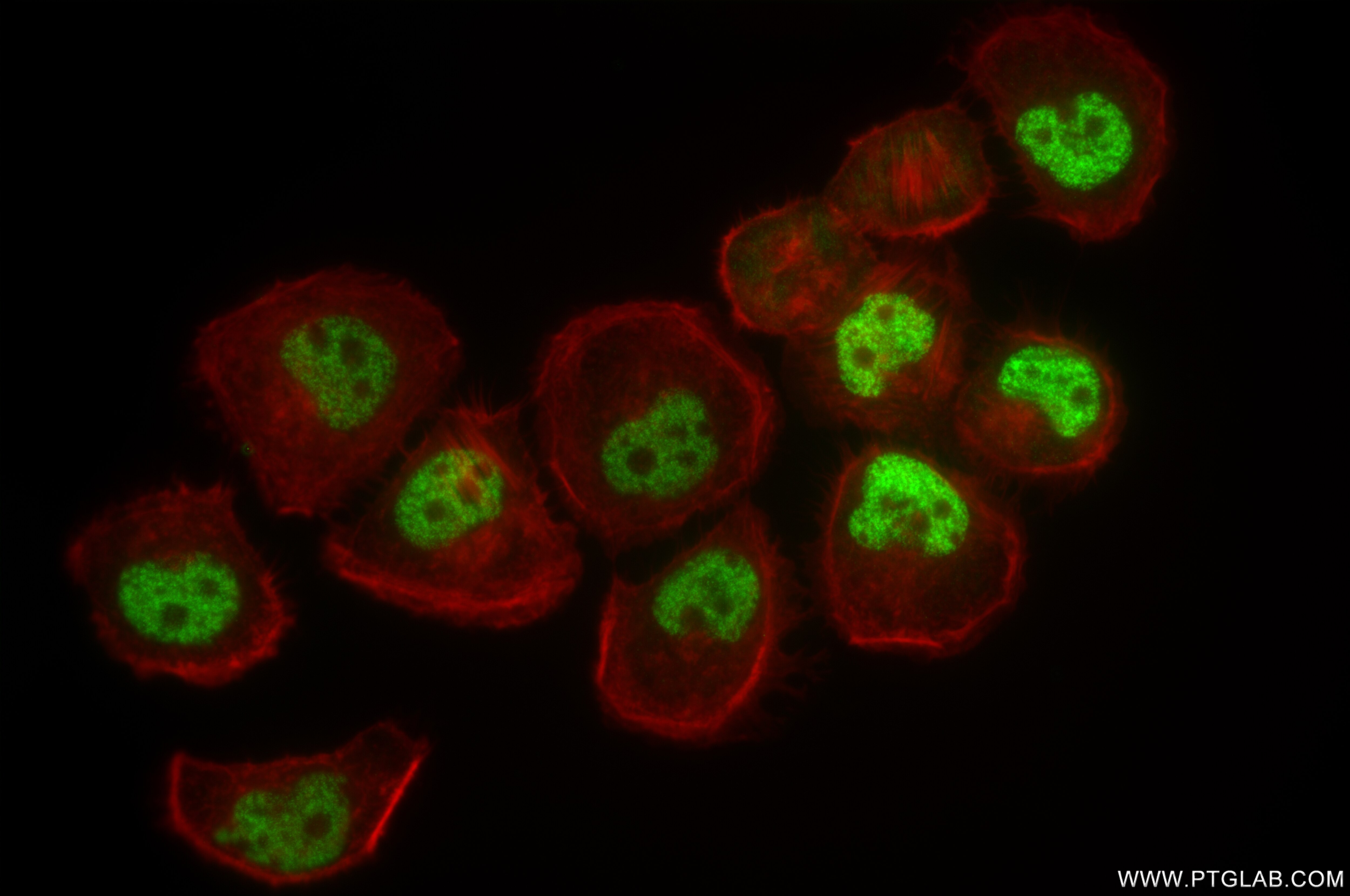 Immunofluorescence (IF) / fluorescent staining of T-47D cells using Progesterone Receptor Recombinant antibody (85112-5-RR)