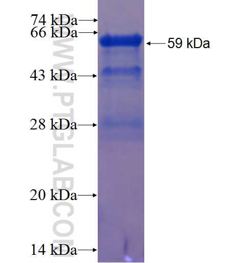 PR fusion protein Ag22986 SDS-PAGE