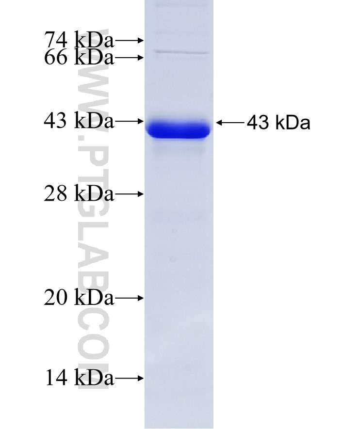 PR fusion protein Ag22992 SDS-PAGE