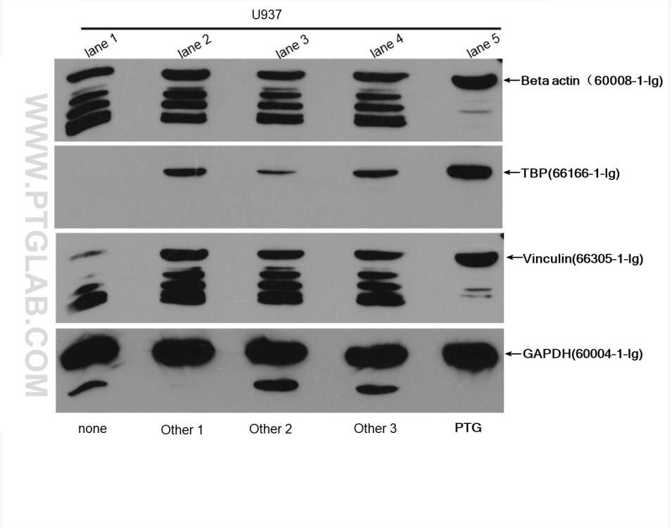 lane1: without protease inhibitor<br> lane 2-4: treated with  protease inhibitor cocktail from three other companies<br> lane 5: treated with Proteintech Protease Inhibitor Cocktail;<br> Western Blot of U973 lysates treated with or without protease inhibitors, using antibodies of Beta actin (60008-1-Ig), TBP (66166-1-Ig), Vinculin (66305-1-Ig), GAPDH (60004-1-Ig), respectively.