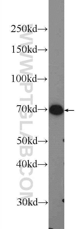 Western Blot (WB) analysis of U-937 cells using PRAM1 Polyclonal antibody (13651-1-AP)