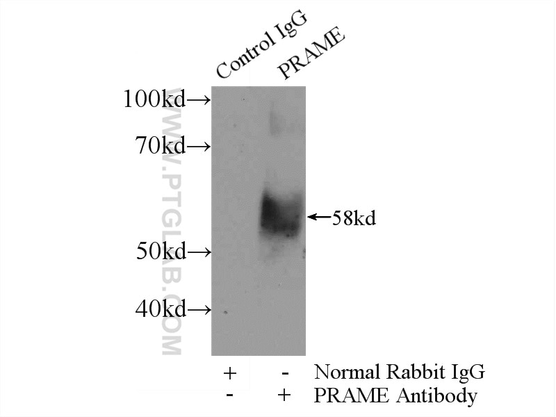 Immunoprecipitation (IP) experiment of A549 cells using PRAME Polyclonal antibody (11438-1-AP)